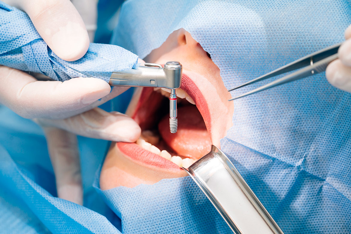 Clínica Médica e Dentária de paranhos - Cirurgia Oral